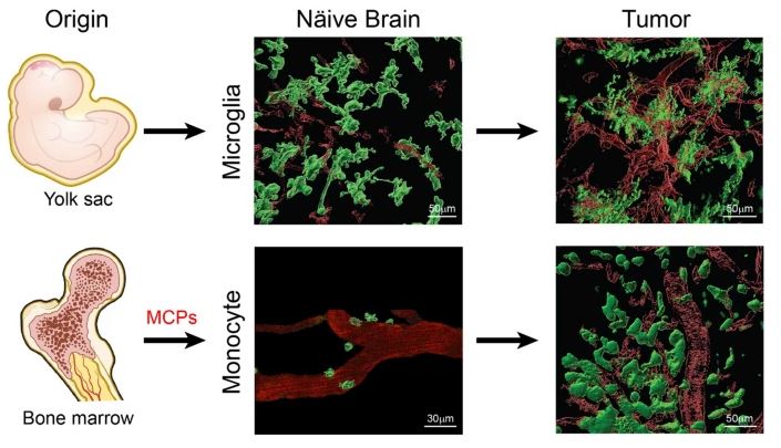 TheNeuroNetwork's tweet photo. Macrophages and microglia: the cerberus of glioblastoma

A new review published in Acta Neuropathologica Communications from @AliceBuonfi and @HambardzumyanL1 

https://t.co/AakvRSwQ35 https://t.co/5qCZe9GB7d