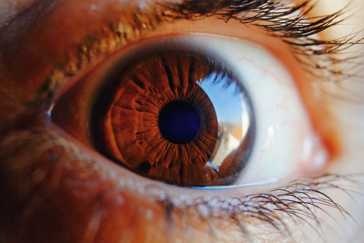 CochraneEyes (@cochraneeyes) on Twitter photo Updated #Cochrane Review on Lens extraction for chronic angle-closure #glaucoma
ow.ly/IPfF50E86Jb
<a href="/Moorfields/">Moorfields Eye Hospital NHS Foundation Trust</a> <a href="/RCOphth/">Royal College of Ophthalmologists</a> #OxfordEyeHospital <a href="/OUHospitals/">OUH</a> <a href="/MassEyeAndEar/">Mass Eye and Ear</a> <a href="/CEVUS3/">USCEV</a> <a href="/CUAnschutz/">CU Anschutz Medical Campus</a> Updated #Cochrane Review on Lens extraction for chronic angle-closure #glaucoma
ow.ly/IPfF50E86Jb
<a href="/Moorfields/">Moorfields Eye Hospital NHS Foundation Trust</a> <a href="/RCOphth/">Royal College of Ophthalmologists</a> #OxfordEyeHospital <a href="/OUHospitals/">OUH</a> <a href="/MassEyeAndEar/">Mass Eye and Ear</a> <a href="/CEVUS3/">USCEV</a> <a href="/CUAnschutz/">CU Anschutz Medical Campus</a>
