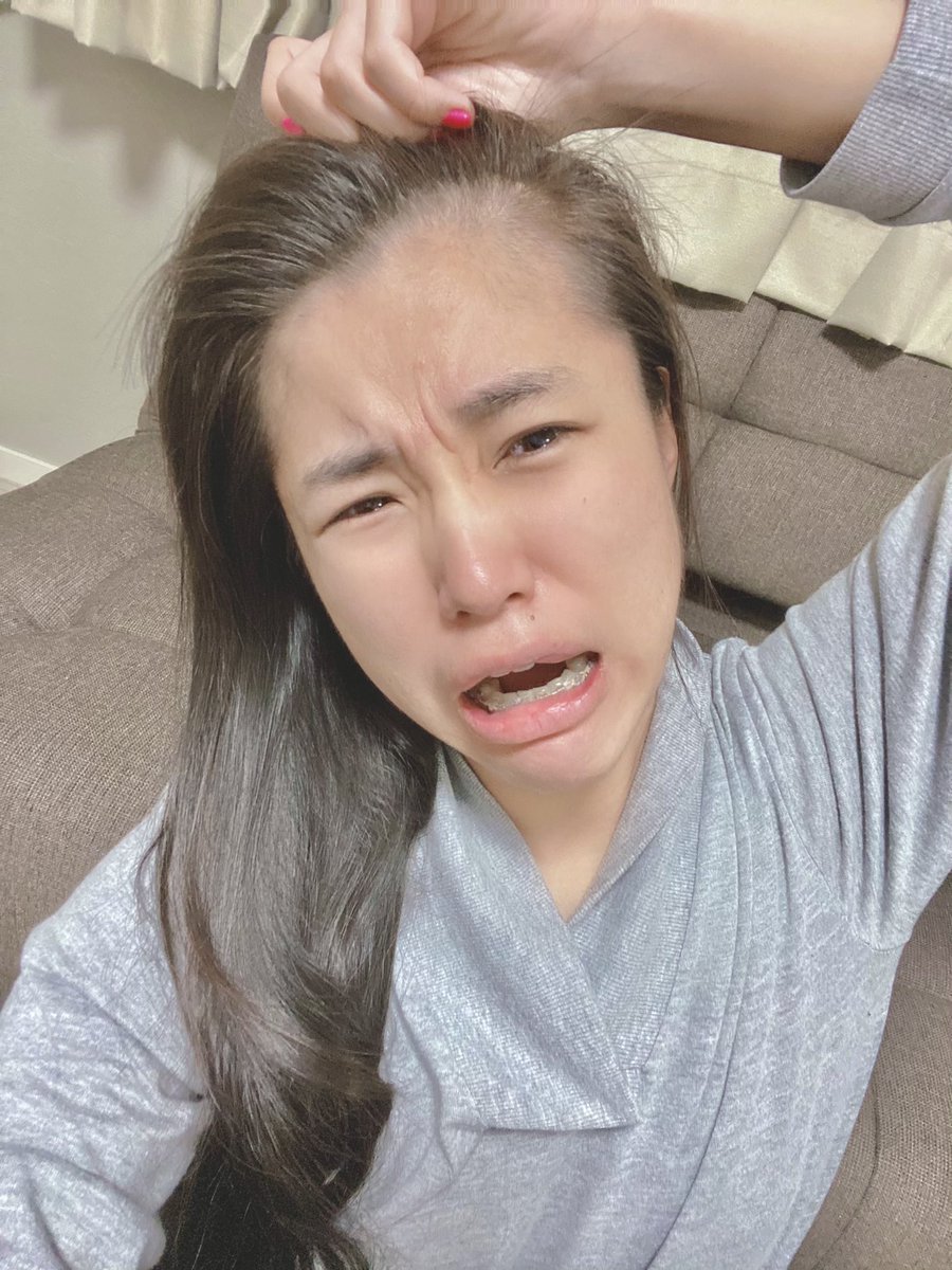 近々アマゾン奥地 みさちゃす 悲報 みさちゃすハゲる エジプトでやった編み込みブレイズ 取ったら前髪の一部がハゲた 2ヶ月もつブレイズ 日本帰って速攻取った わずか5日間 髪がごっそり抜けて全体的に毛量減 しばらくの間ハゲを隠しハゲとして