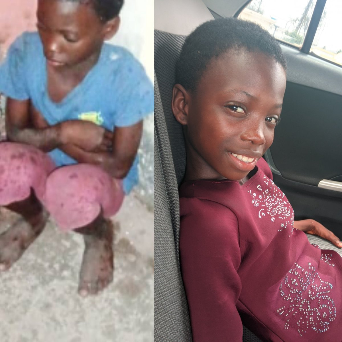 brcinigeria's tweet photo. Esther ( pictured below)is an orphan. She needs a Foster care family resident in Cross River State or Akwa Ibom State. Please kindly contact BRCI  on: 0809 012 3666 or 0906 042 6199 or visit 15 Kings street Bigqua Calabar. https://t.co/TN6WOTOUTA
