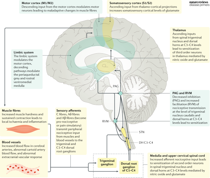 Chronification of tension-type #headache involves sensitization of #spinal and supraspinal #neurons, and decreased antinociceptive activity from the brain go.nature.com/2Pn2VpU