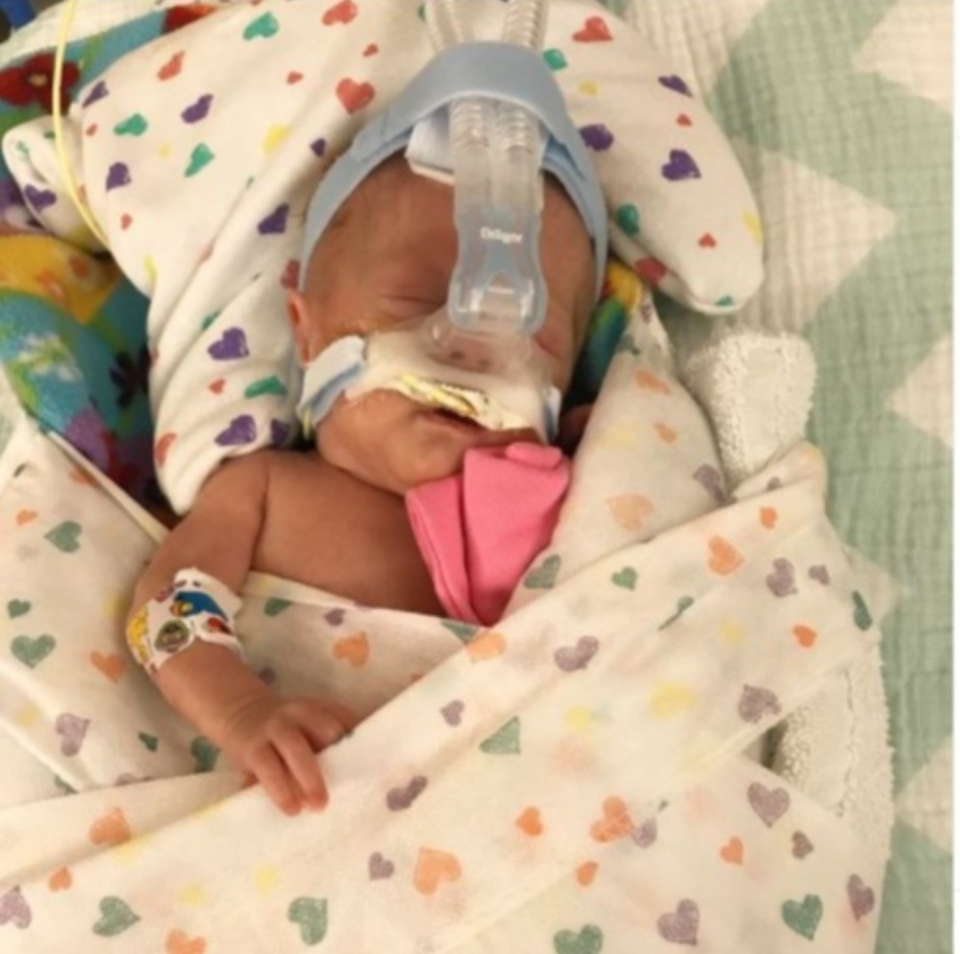 ChildrensSpecNJ's tweet photo. Colbie Durborow was born at 23 weeks &amp; spent 153 days in the #NICU.  Two years later, Colbie was diagnosed with #CerebralPalsy.

Today, Colbie is a thriving 3 year old &amp; loves her #PhysicalTherapy sessions.💚 

#CerebralPalsyAwarenessDay #CerebralPalsyAwarenessMonth #GoGreen4CP https://t.co/84pwRc2S6h