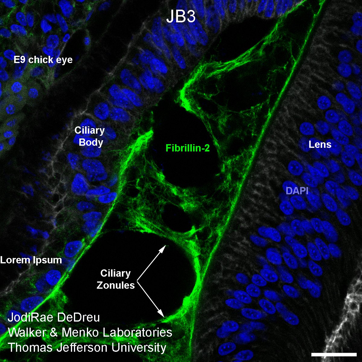 DSHB_antibodies's tweet photo. Fibrillin-2 provides a permissive matrix for immune cells migrating from the ciliary body to the lens (PMID: 33710665). Order JB3 (RRID: AB_531777) at $40/ml. Go to https://t.co/9srXBnSbc5 #eyedevelopment https://t.co/RWagKxtPwv