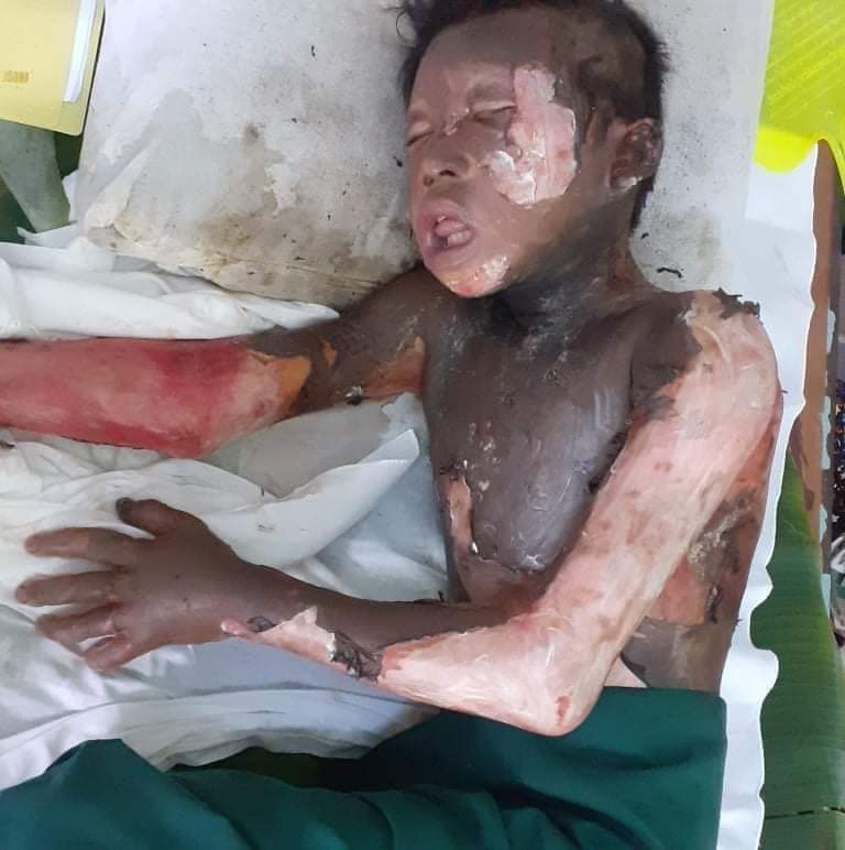 PaingPhyoeThu9's tweet photo. TW // sensitive content
In DaungShaungVillage,#Launglone township,#Dawei Junta's SAC burned down the scout's house.All 7 family members are in critical condition and the youngest child(only 13) died due to severe burning.
#WhatsHappeningInMyanmar
#Mar25Coup https://t.co/XQ41DIbTfG