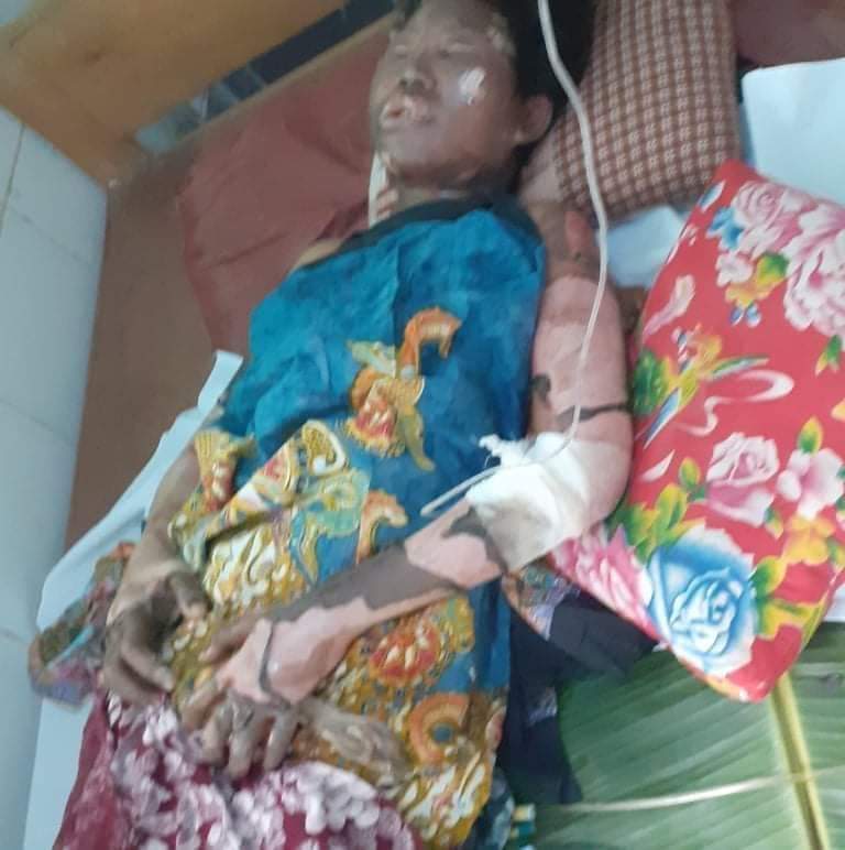PaingPhyoeThu9's tweet photo. TW // sensitive content
In DaungShaungVillage,#Launglone township,#Dawei Junta's SAC burned down the scout's house.All 7 family members are in critical condition and the youngest child(only 13) died due to severe burning.
#WhatsHappeningInMyanmar
#Mar25Coup https://t.co/XQ41DIbTfG