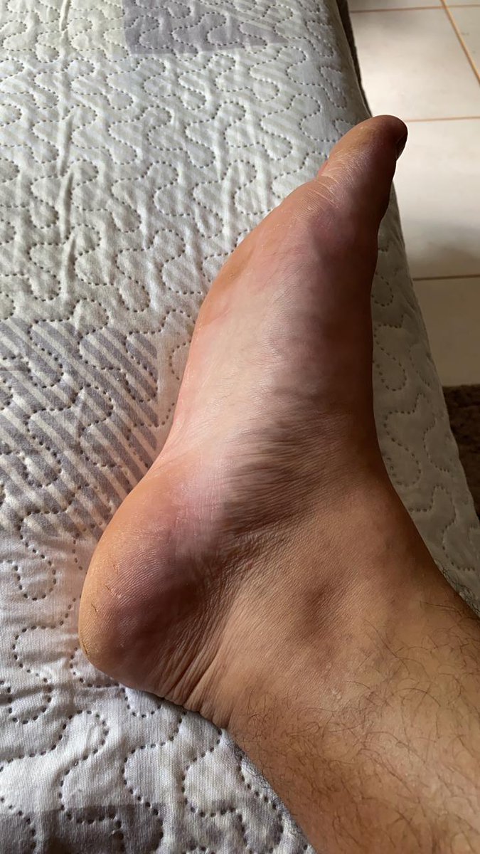 pfeetsuper's tweet photo. #timetorelax #feet #feetish #salepictures #masterfeet https://t.co/bZGiYFPgJ5