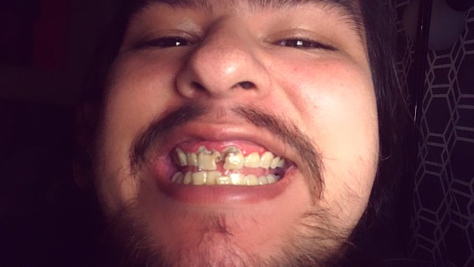 Still teaching myself to love and accept my smile for now.  Step 1: create content  Step 2: build a home<a href="/tag/lifegoals"class="tags"><span>#lifegoals</span></a><a href="/tag/mentalhealth"class="tags"><span>#mentalhealth</span></a>