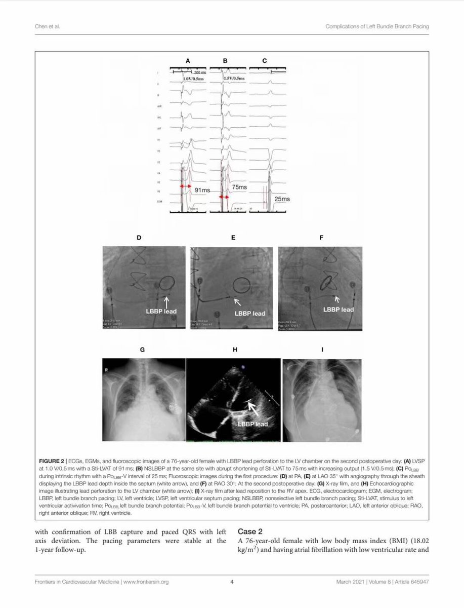 Xueying Chen, MD, PhD, FHRS tweet media