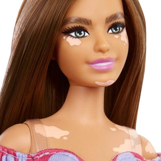 Exciting news about the upcoming launch of a new #Barbie featuring #vitiligo! It's just amazing to see diversity celebrated in this wonderful toy collection. Check out our new article for the full story 💜👫👏

vitiligosociety.org/vitlife/mattel…