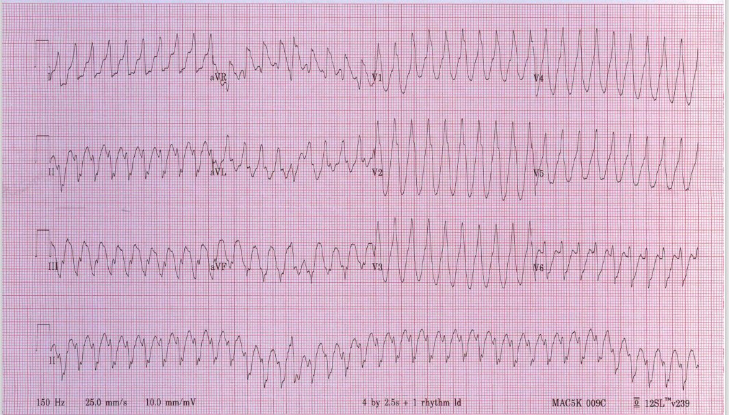 Case from today's clinic. 