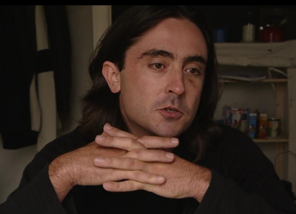 And so in summary, superglue is not a good substitute for hand cream. Thank you for listening to this Ted Talk.