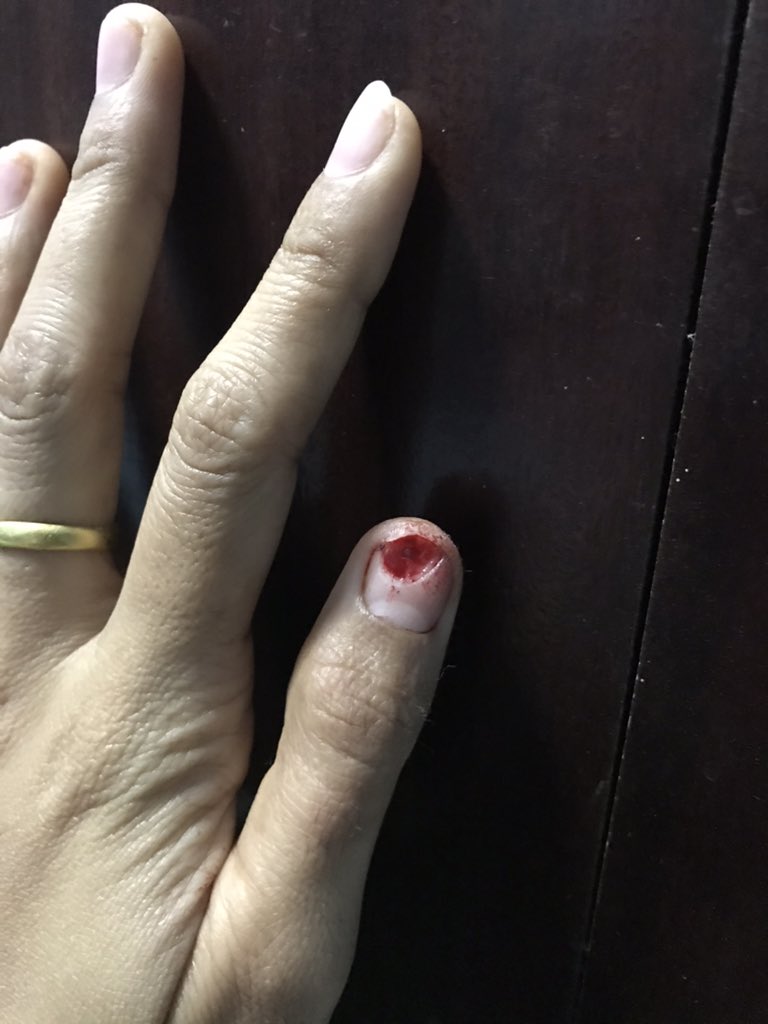 Guakul's tweet photo. เจ็บนี้มันลึก😢😢 https://t.co/bKbVeZdNG4