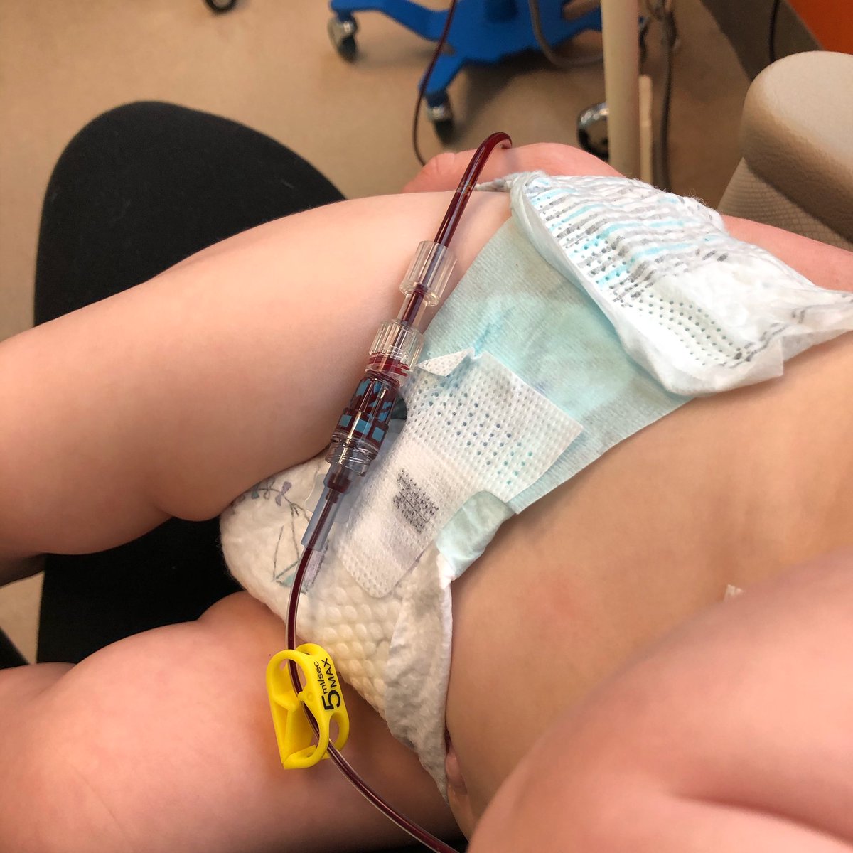 melissadingmon's tweet photo. If you want to help kids fighting cancer, like my sweet Remy, please donate blood and platelets to your local blood bank. @BloodworksNW 

#neuroblastoma #help https://t.co/YYhpIgsezd
