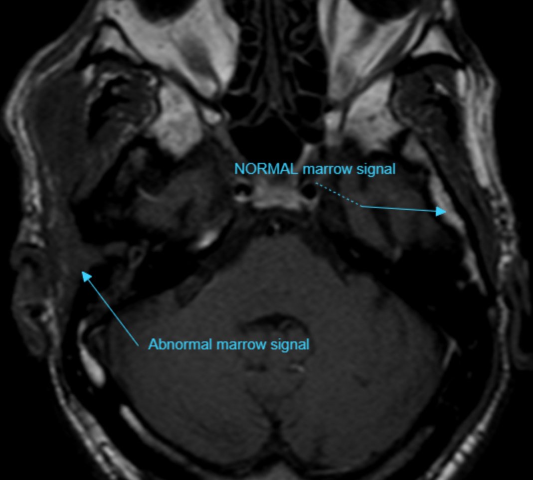 UMaryland Neuroradiology tweet media