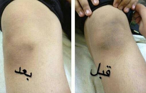 ايه افضل علاج اماكن الغامقه اللي عايز يعرف يسال خاص انا تحت امر اي حد