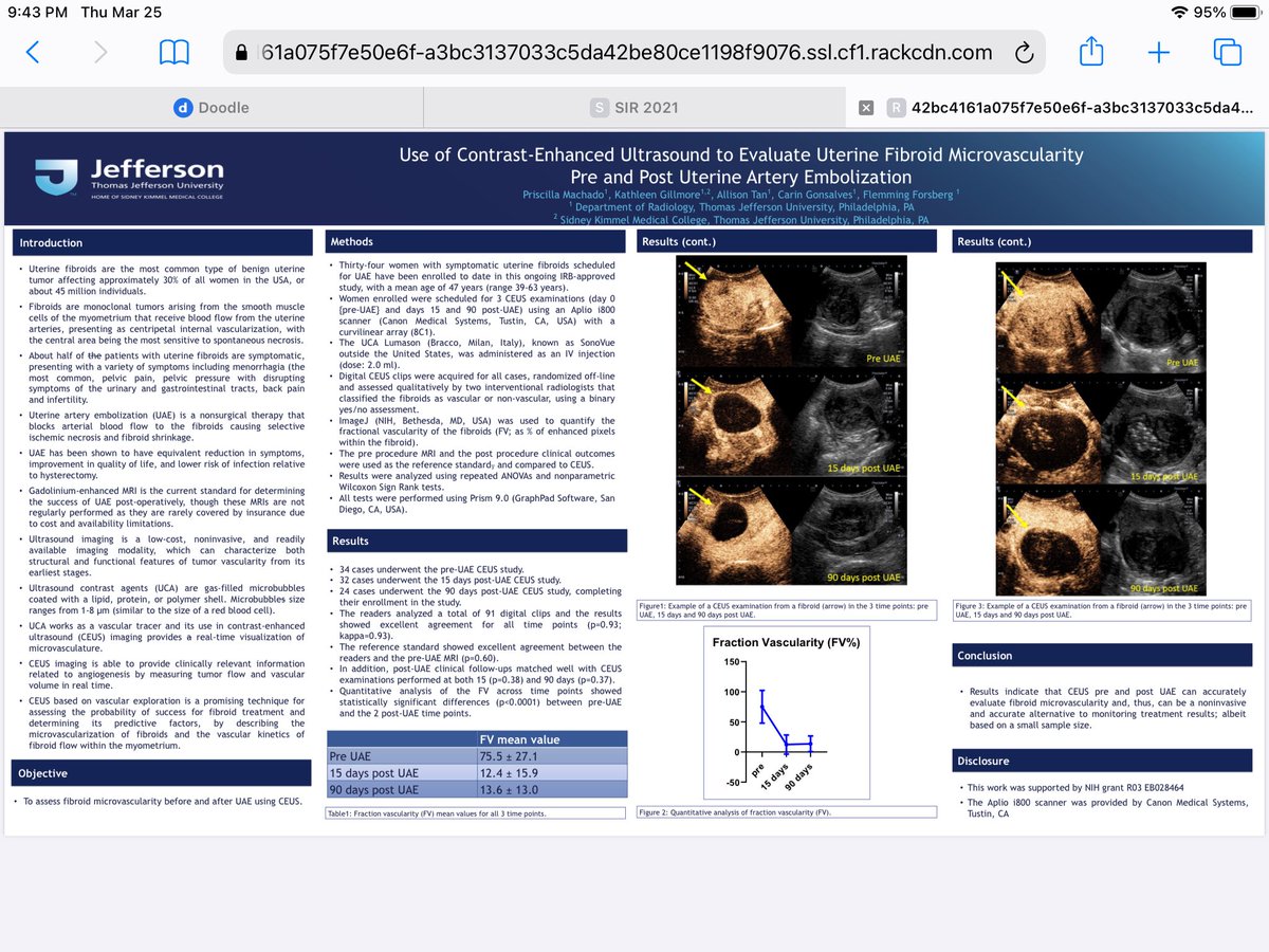 carin_gonsalves's tweet photo. Perhaps one day, CEUS will be used in IR clinics to assess UAE success. Awesome work Priscilla ⁦@JeffersonUniv⁩ ⁦@JeffersonRads⁩ ⁦@allison_tan_md⁩ ⁦@VP⁩ ⁦@womenirads⁩ ⁦@SIRspecialists⁩ ⁦@ask4UFE⁩ https://t.co/nNRpSR0GRo