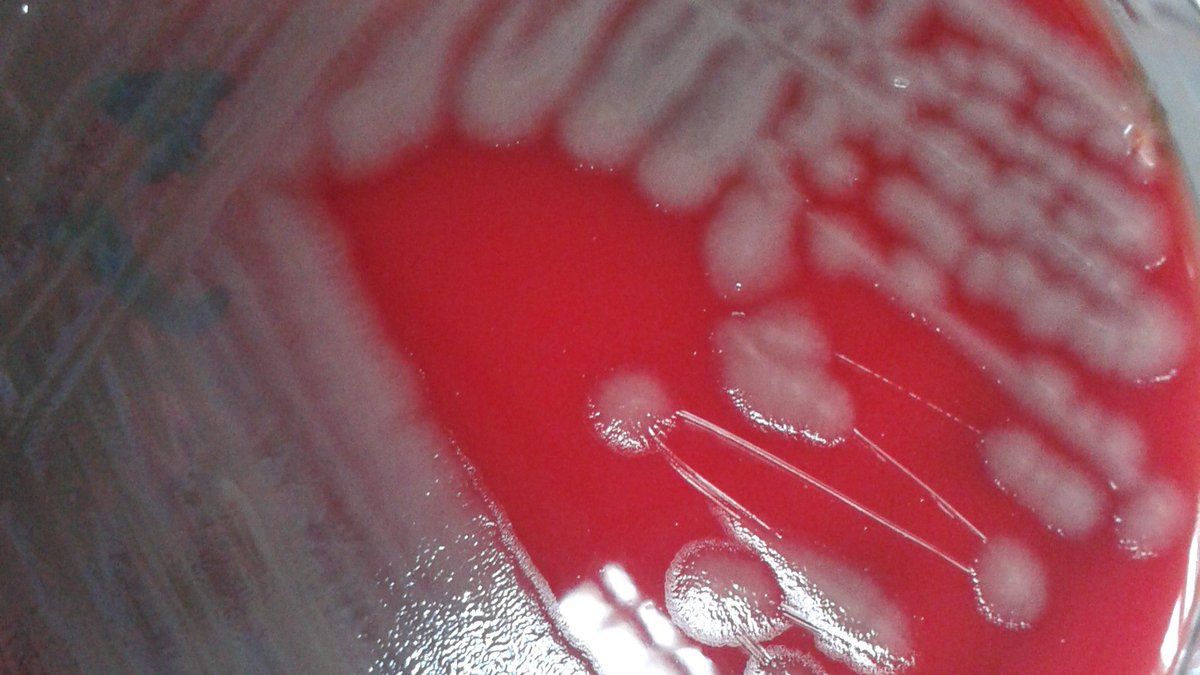 guiasdemicro's tweet photo. Pseudomonas aeruginosa MDR:

Resistencia enzimática en P.aeruginosa, aspectos clínicos y de laboratorio.
https://t.co/Jw8jUWv1zU

Resistencia mediada por eflujo MexAB en P.aeruginosa aisladas de pacientes con IAAS.
https://t.co/N2L4yAMSem https://t.co/ceXIElVFTc