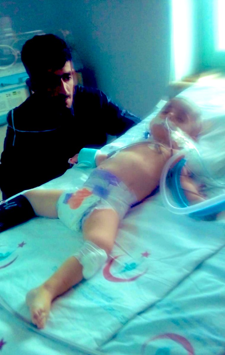 İlyas Gür 3 yaşında.

100 milyonda 1 görünen mitokondral kas hastası.

Kalbi %16 çalışıyor.

Günde 13 ilaç alıyor

Babası kalp ameliyatlı ve çalışamıyor. 

Maddi durumları çok kötü.

Çocuğun tedavisine destek sunmak ve aileye dayanışma sunmak isteyen bize özelden ulaşabilir.