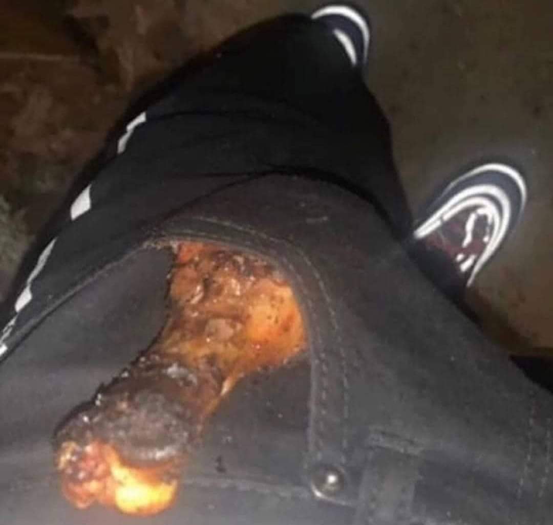 por si me da la palida