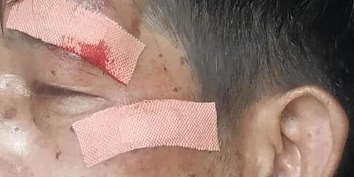 KathIris20's tweet photo. Happening in Mawlamyaing; A man who s about to go monastery to donate lunch to monks was brutally beaten n ordered to clear barriers on roads. Armed forces even robbed his motorbike.

INTERNET DARK ERA
#WhatsHappeningInMyanmar
#Mar26Coup https://t.co/BUtmRFMQta