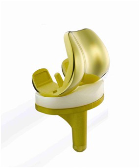 DrAmberMittal1's tweet photo. Why Golden Knee Replacement Surgery is in Boom, Read our blog https://t.co/ylZ2SRzSoE

#GoldenKneeReplacementSurgery #kneesurgeryindore #BestKneereplacementSurgeon
Amber Mittal's
Centre for Advance Joint Replacement
Visit us https://t.co/qbA84OIngw https://t.co/Ma3zeJglJt