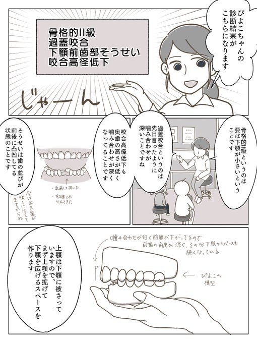 子供の歯科矯正漫画③
検査結果と上顎の治療開始について。
記憶を辿って書きましたが説明間違ってたらすみません…

#育児漫画 #育児絵日記 #小児歯科矯正 #歯科矯正 