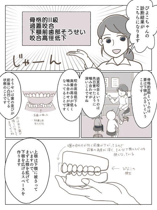 子供の歯科矯正漫画③
検査結果と上顎の治療開始について。
記憶を辿って書きましたが説明間違ってたらすみません…

#育児漫画 #育児絵日記 #小児歯科矯正 #歯科矯正 