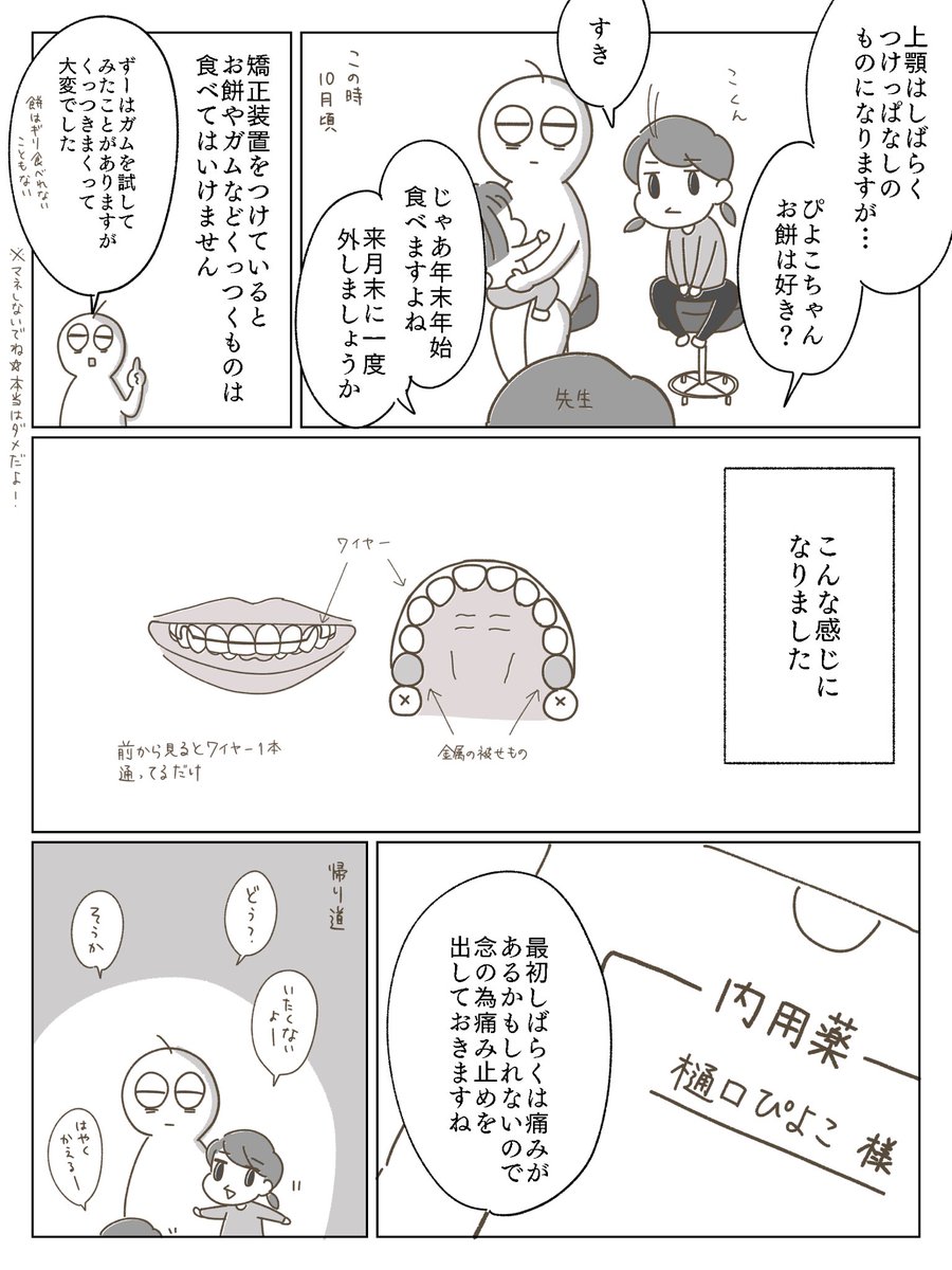 子供の歯科矯正漫画③
検査結果と上顎の治療開始について。
記憶を辿って書きましたが説明間違ってたらすみません…

#育児漫画 #育児絵日記 #小児歯科矯正 #歯科矯正 