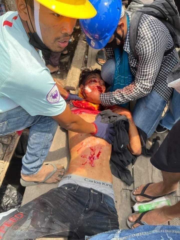 Zinlayy3's tweet photo. TW//Myeik 
The Terrorists Group Of Military Coup being violently crackdown to protesters that 4 people have been injured and a young girl are arrested. 
#WhatsHappeningInMyanmar
#Mar26Coup https://t.co/lsZdx9lmMM