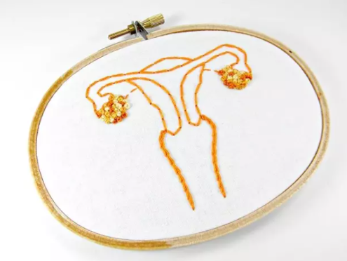 📌Un estudio publicado en 'Stem Cells' asocia el agotamiento de las células madre en el útero con la pérdida recurrente de #embarazos

▶▶ bit.ly/3rqfkXg

#abortosderepeticion