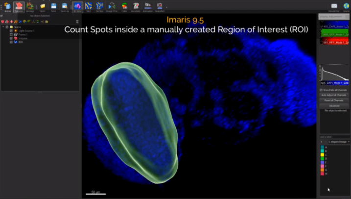 ImarisSoftware's tweet photo. Find out how to count objects inside the user defined region of interest...
Watch our super speedy 60 second #tutorial >> https://t.co/6b6YjUkn1b
#Imaris95 #ImarisLearning https://t.co/klqcnteZ4x