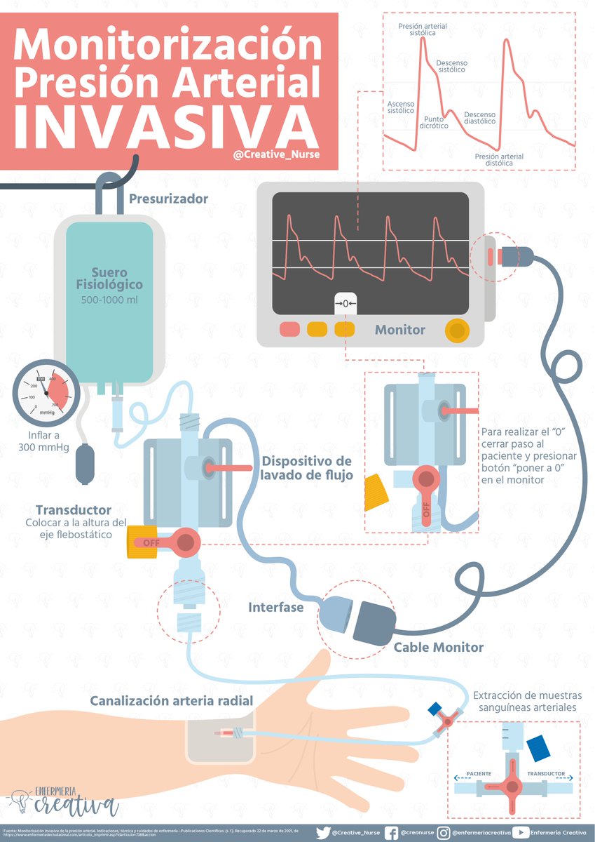 Creative_Nurse's tweet photo. 🆕Monitorización Presión Arterial Invasiva
#infografía #Enfermeria 

➡️https://t.co/kPU2nTa9lO https://t.co/LOQGvTJ2DB