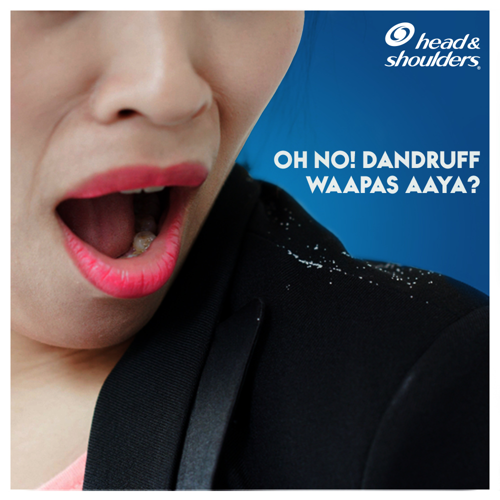 hnsIndia's tweet photo. Is your sticky hair oil making it difficult to stick to your long weekend plans? Beat dandruff and jhanjhats of applying hair pack with the new Head&amp;Shoulders Neem. 
#headandshouldersneem #headandshoulders #nowwithneem #antidandruff #antidandruffshampoo https://t.co/C3NBTFIqvP