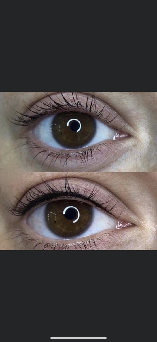 🌸kalıcı diplıner açılışa özel fiyat fırsatlarını kaçırmayın.
☎️0541 259 77 31
#sakarya #sakaryakalıcımakyaj  #sakaryaeyeliner  #sakaryadipliner  #sakaryakirpik  #sakaryakirpiklifting  #sakaryamikroblading  #sakaryamikropigmentasyonkaş  #sakaryalazerepilasyon  #sakaryabuzlazer