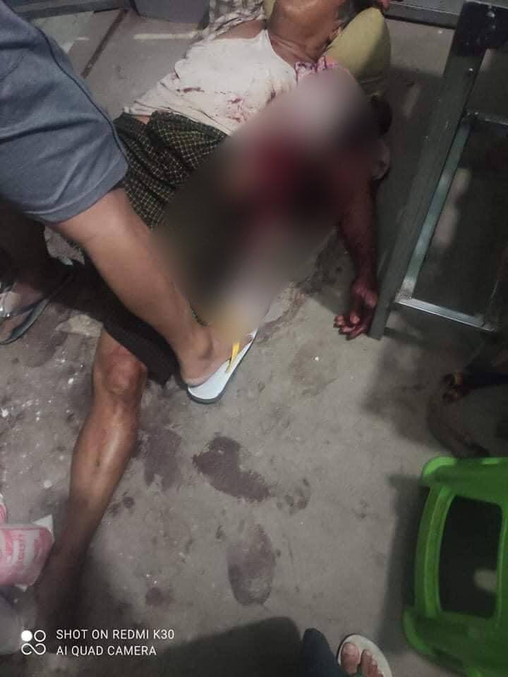 nay_yeyyy's tweet photo. Happened Now In Mandalay
Terrorists(SAC) indiscriminately shot a civilian in 58th Street, Manaw Harry. He is now in critical condition.
NEWS SUPPRESSION 
#WhatsHappeninglnMyanmar #Apr2Coup #MilkTeaAlliance
#InternetShutdown https://t.co/zDDIUkkTJK