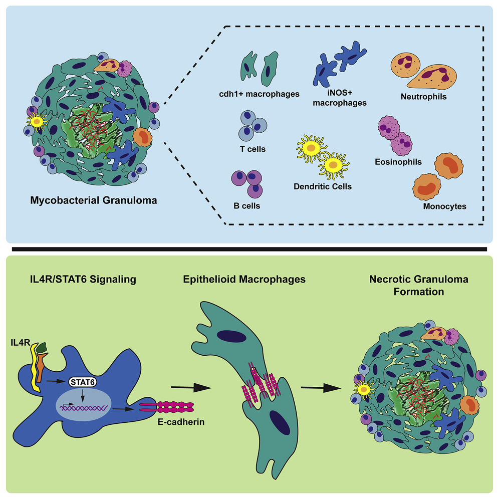 CellCellPress's tweet image. In the latest issue! #Mycobacterial #infection causes a non-canonical type 2 #immune #response responsible for the formation of the granuloma, the #hallmark of #tuberculosis. bit.ly/3sLODhl @TobinLab @DukeMedSchool