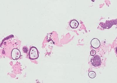 UChicagoOSRF's tweet photo. NEW CORE: Organoid &amp; Primary Culture Research Core in the Dept of Pathology. https://t.co/ZbN8bAOcVm https://t.co/Zqy8DsbT6R