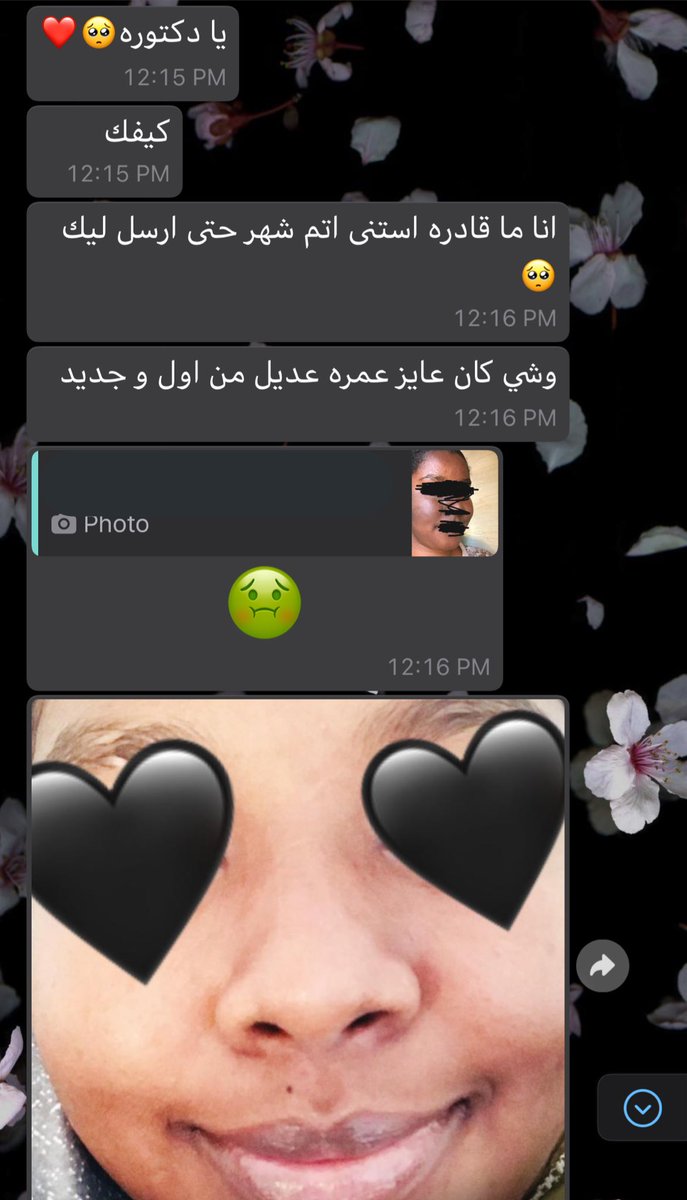 shineandglowcos's tweet photo. عشان الريفيو الخرافي دا "ماشاءالله" 
حابة اهديكم كريم و سيرم كريستال نفس الاستخدمته البنوتة في التحربة دي و نكون سبب سعادة وحدة تانية كمان ♥️♥️

كل المطلوب منك تعملي ريتويت و تختي لينا قلوب ♥️♥️♥️ في كومنت 

اللي حرد عليها ب ♥️ معناها هي الفايزة بالكريم و السيرم 😘♥️ https://t.co/tj5g3EpEDS