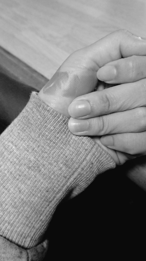 さかな イボの残留を試しにひとつティーツリーとスピール膏で駆除したのがわりとうまくいったからもうひとつもやってみている 場所が悪くてテープ貼るの大変 T Co Hvvkdnd5um Twitter