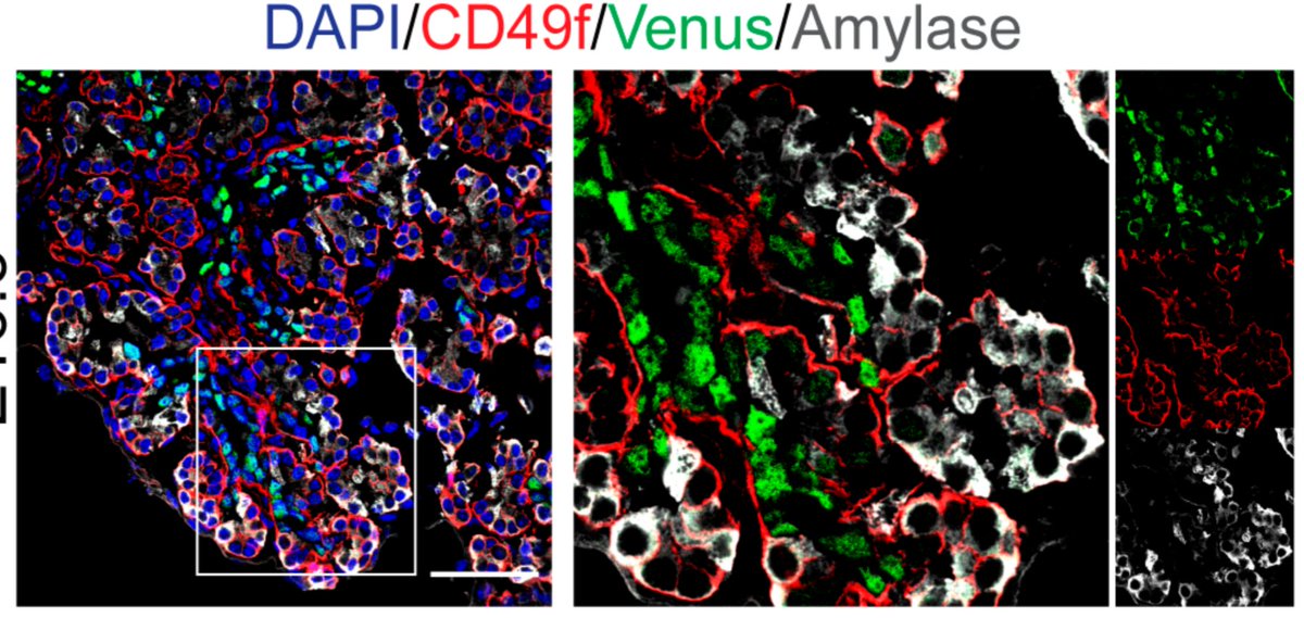 Heiko Lickert (@lickertheiko) on Twitter photo Great new Nkx6-1 Venus fusion mouse line to study pancreas development and beta cell biology! Great effort lead by Ingo (not on Twitter) and colleagues <a href="/bakhti_mostafa/">Mostafa Bakhti</a> <a href="/MartaTarquis/">Marta Tarquis-Medina</a> <a href="/CiroSalinno/">Ciro Salinno</a> Silvi and Julia! Here is the download link:
mdpi.com/1422-0067/22/7… Great new Nkx6-1 Venus fusion mouse line to study pancreas development and beta cell biology! Great effort lead by Ingo (not on Twitter) and colleagues <a href="/bakhti_mostafa/">Mostafa Bakhti</a> <a href="/MartaTarquis/">Marta Tarquis-Medina</a> <a href="/CiroSalinno/">Ciro Salinno</a> Silvi and Julia! Here is the download link:
mdpi.com/1422-0067/22/7…