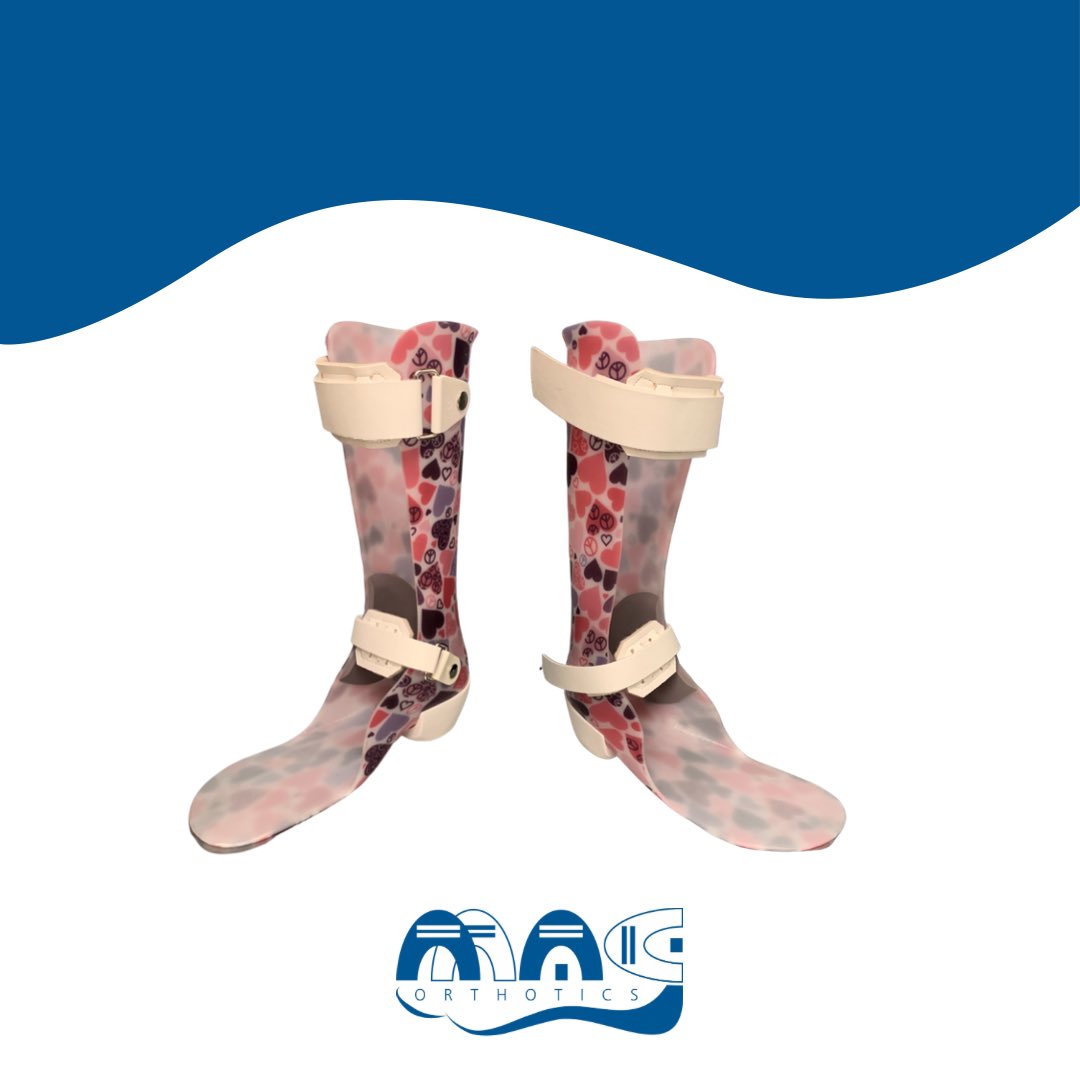 MAGOrthotics's tweet photo. AFO's are intended to control the position and kinetics of the ankle, correct abnormalities or compensate for infirmity. Transfers may be applied to make the AFO aesthetically pleasing. https://t.co/LwOZmr64yQ https://t.co/pUgagZC9jo
