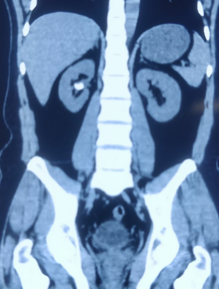 Karthickeyan N tweet media