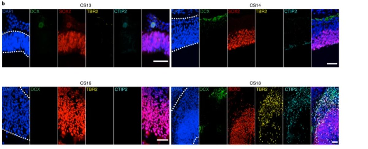 enlightenbio's tweet photo. Researchers use #singlecell #RNAsequencing : found 9 progenitor populations proximal to telencephalon & thatorganoid systems -> comprehensive molecular & #spatialatlas of early human #brain stages & #cortical development.
Publ. in @NatureNeuro
#neurology
https://t.co/ldQAlhym3l https://t.co/5p0dS034fJ