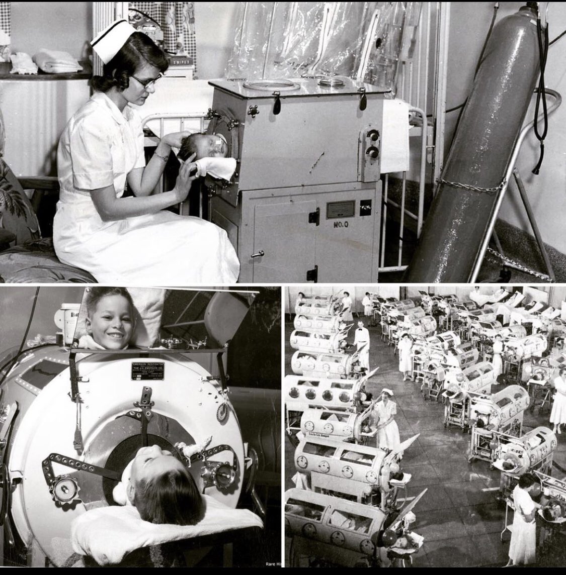 Çocuk felci virüsünün aşısı olmadan önce yüzme havuzundan virüsü kapan çocuklar görseldeki demir akciğerlerin içinde yaşamak zorunda kalıyorlardı. 1955’te Jonas Salk isimli bilim insanı çocuk felci aşısını buldu ve artık bu görüntüler tarihte kaldı.