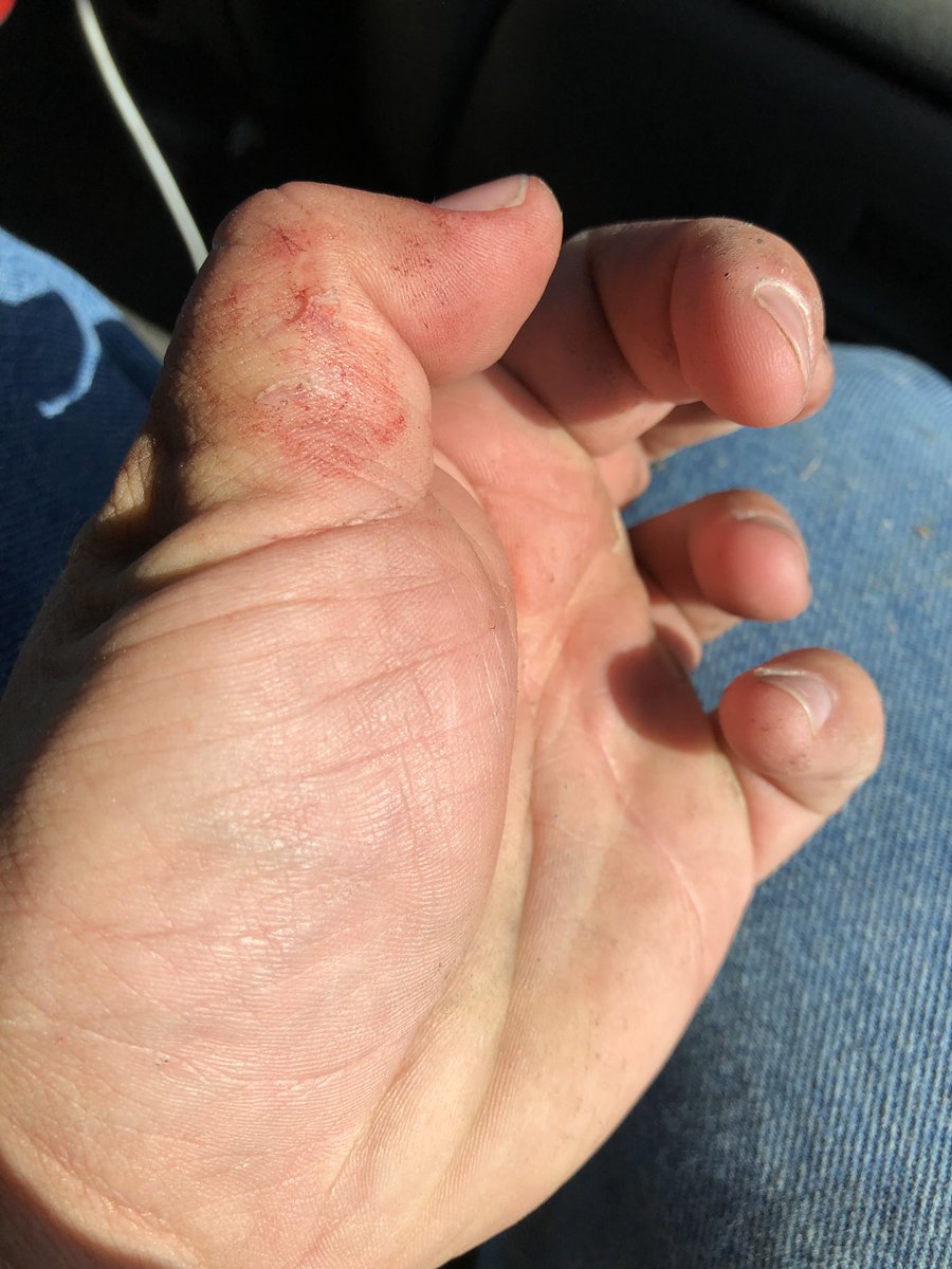 len0killer's tweet photo. Good as new #ThomasMedical https://t.co/erIW72OTp9