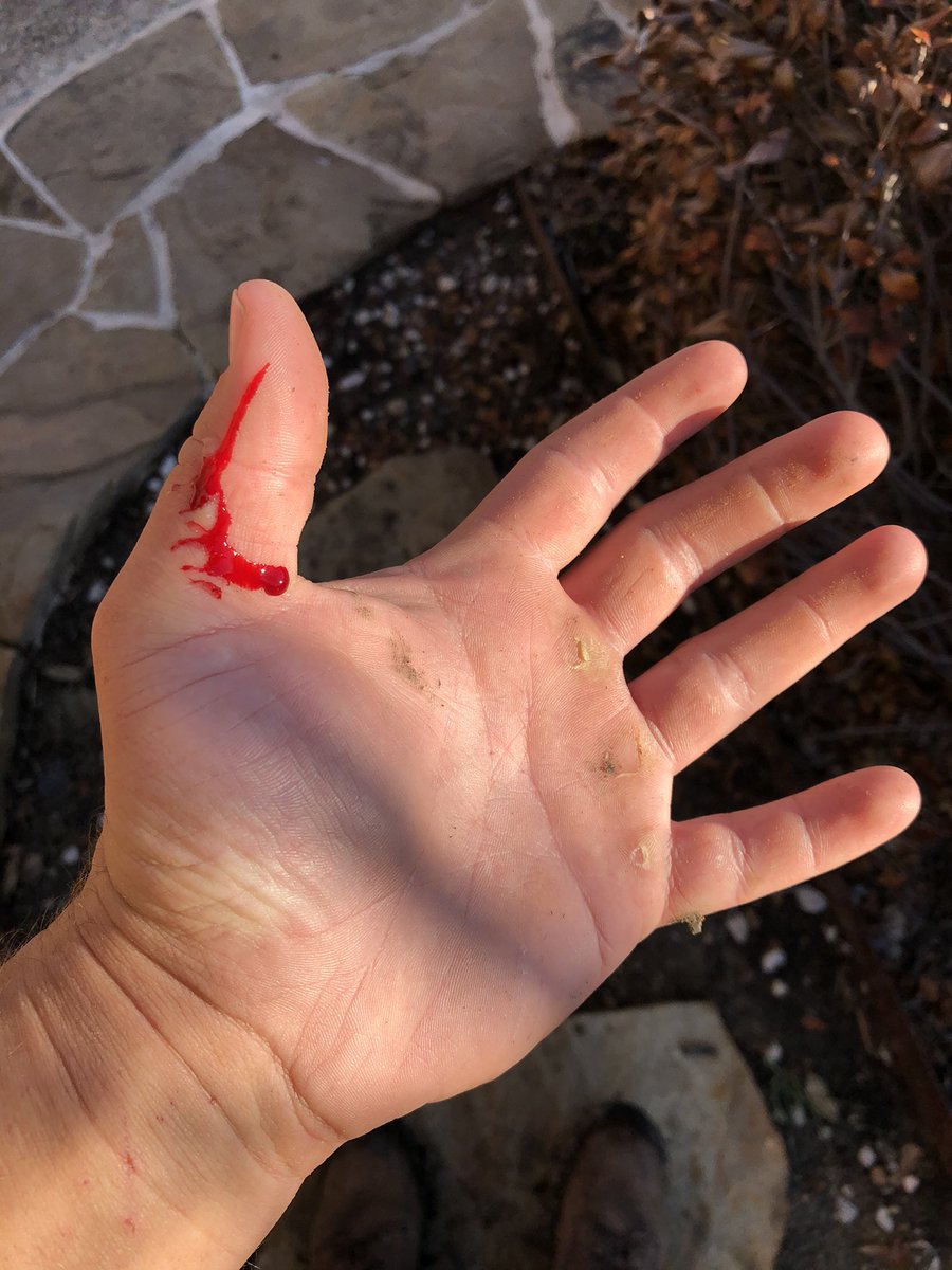 len0killer's tweet photo. Good as new #ThomasMedical https://t.co/erIW72OTp9