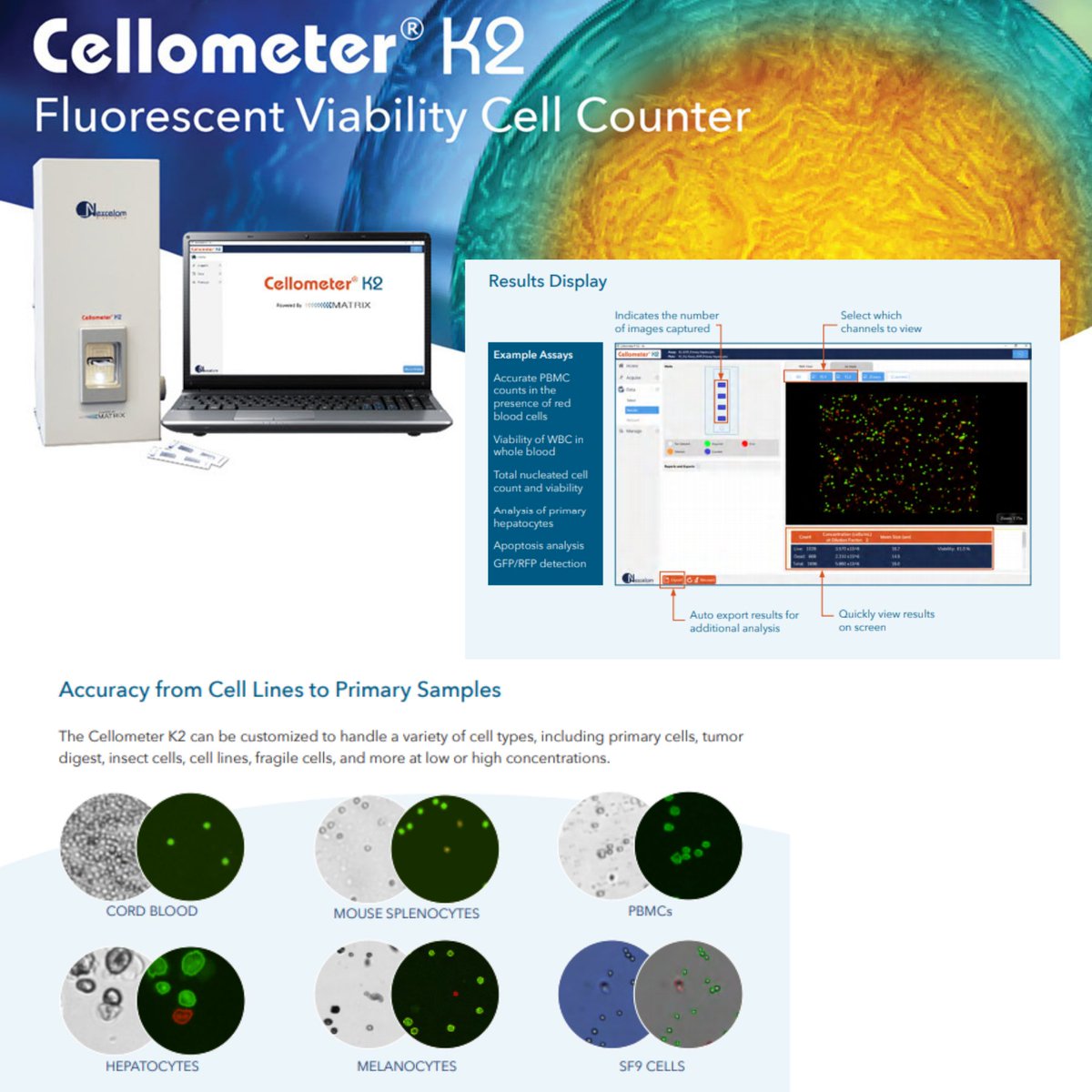 Nexcelom's tweet photo. Count cells in the Matrix!
We are excited to announce the release of the #Cellometer K2 Cell Counter with the new #Matrix software that offers a modernized interface and simplified workflow. Now 21 CFR Part 11 ready!
Download the new brochure!
https://t.co/dnDLCK8nbt https://t.co/ETCOcqtX1r