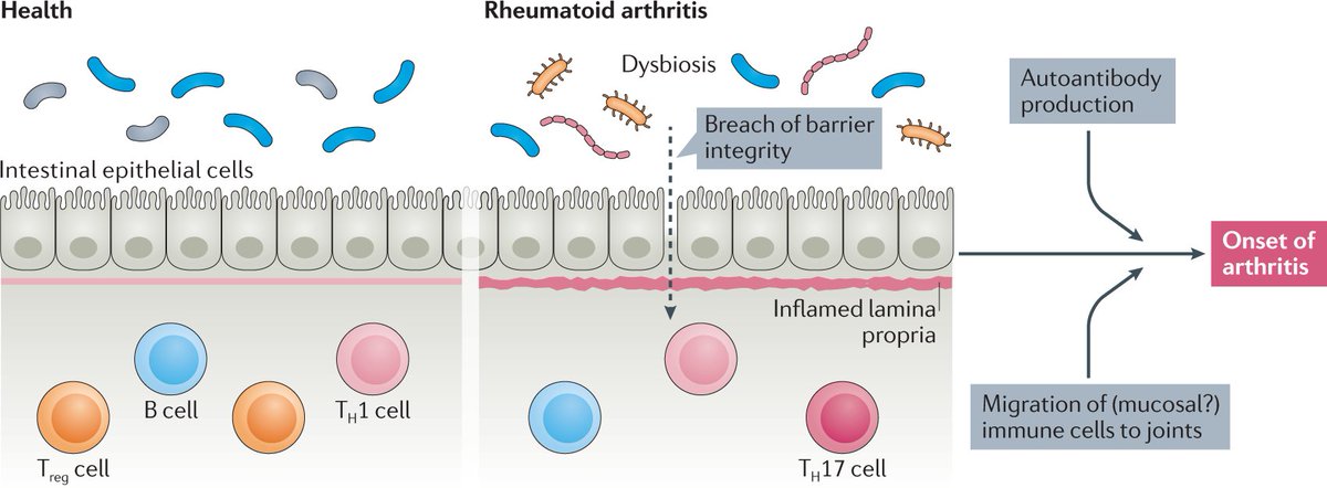 NatRevRheumatol's tweet image. #AprilIssue | Intestinal dysbiosis is thought to be involved in the early stages of rheumatoid #arthritis (RA). In this #Review, the authors discuss the #gut–#joint axis in RA and the potentially pathogenic role of gut-derived immune cells in the joints.

go.nature.com/3crpWBf
