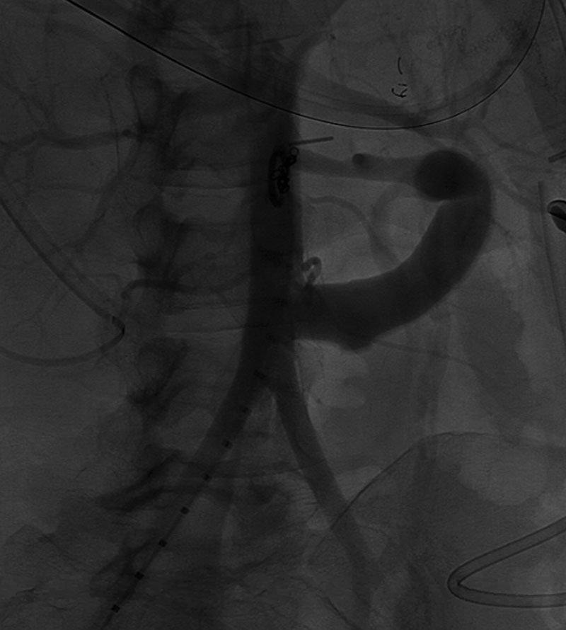 TransplantDirect tweet media