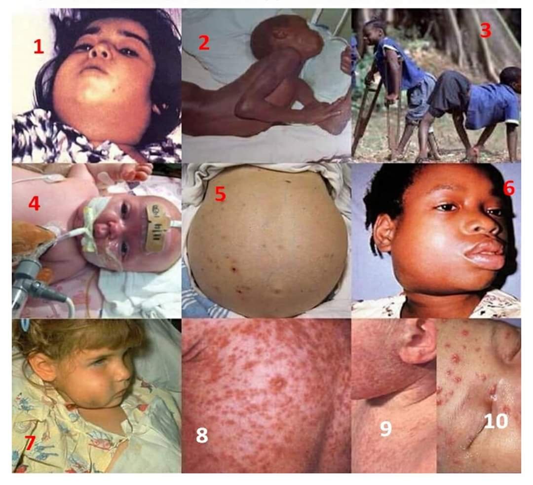 mICROBIOsh's tweet photo. Sabías que todas las siguientes enfermedades son prevenibles con #VACUNAS 💉
1.Difteria 
2.Tétano
3.Polio 
4.Tos ferina 
5.Hepatitis B
6.Parotiditis
7.Haemophilus influenzae 
8.Sarampión 
9.Rubéola 
10.Varicela https://t.co/w6yE51oS1R
